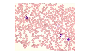 GIEMSA’S STAINING SOLUTION