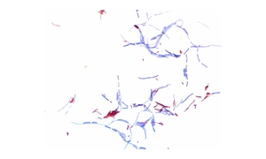 CARBOL FUCHSIN STRONG [STAINING SOLUTION(ZIEHL NEELSEN)]